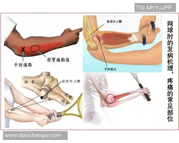 南京网球队区域防守策略解析与深度剖析网球竞技的战术魅力
